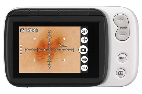 Image of the DZ-D100 (CASIO) camera with contact dermoscope function