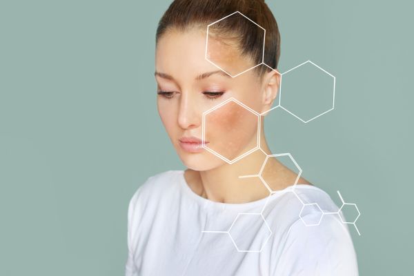 Image of skin treatment